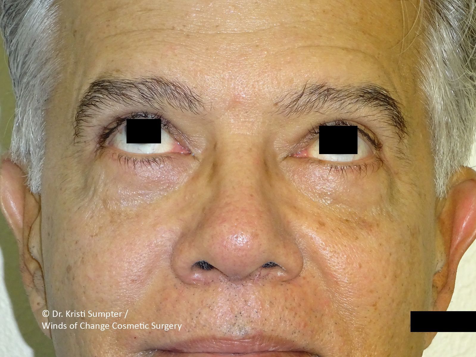Close-up of a face looking up after.
