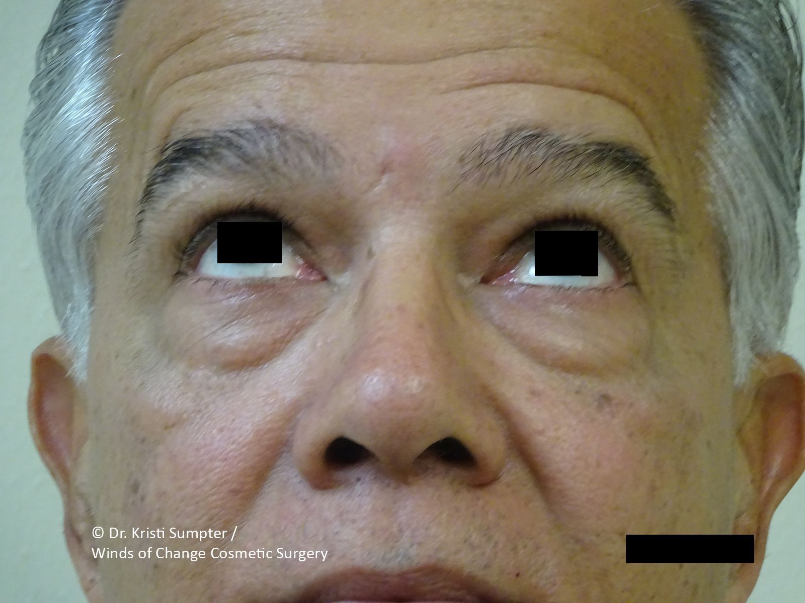 Close-up of a man's face looking up before.