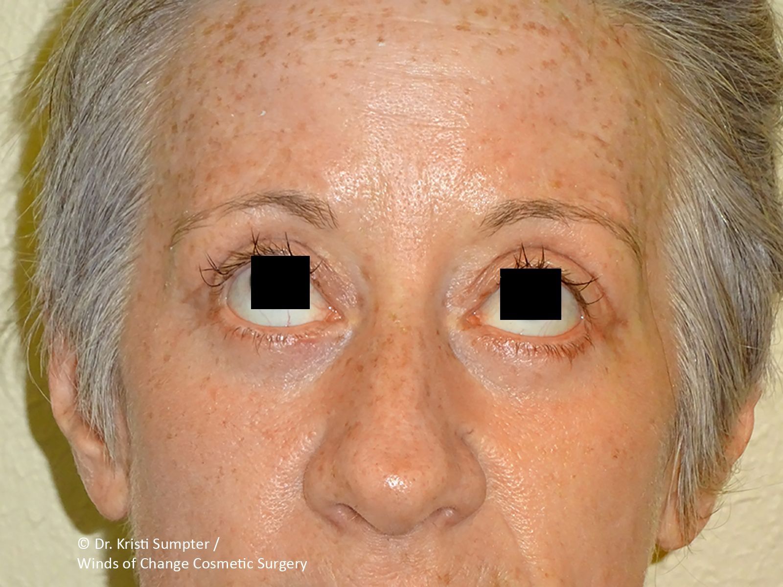 Close-up of a woman's face looking up after.