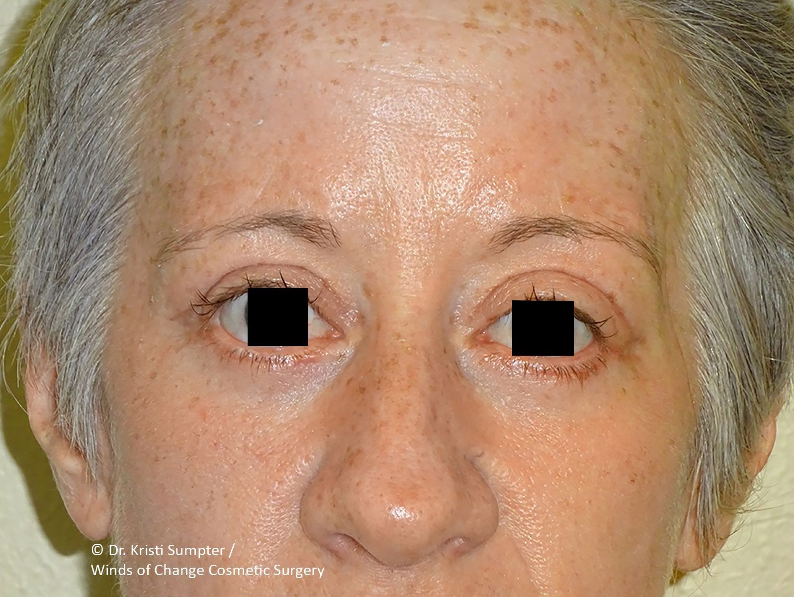 Close-up of a woman's face looking forward after.