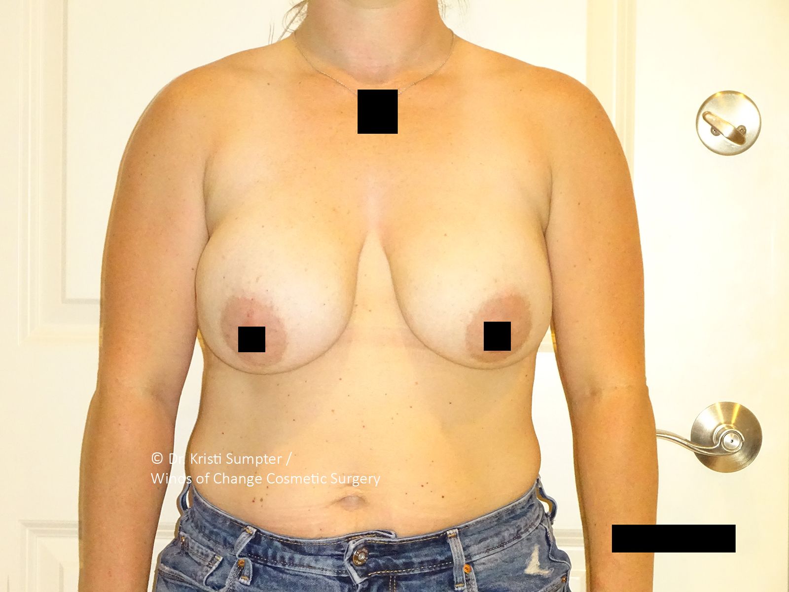 Woman in jeans, upper body visible, chest and neck obscured by black boxes.