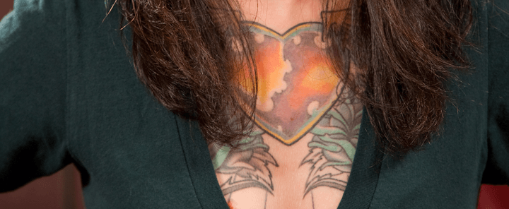 Laser Removal Resources | Houston Tattoo Removal Clinic