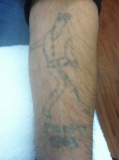 Tattooed forearm