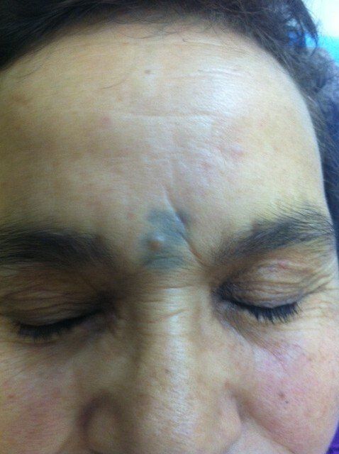 Tattoed forehead