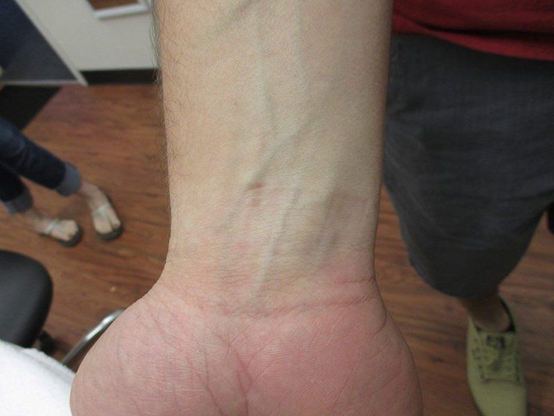 Wrist