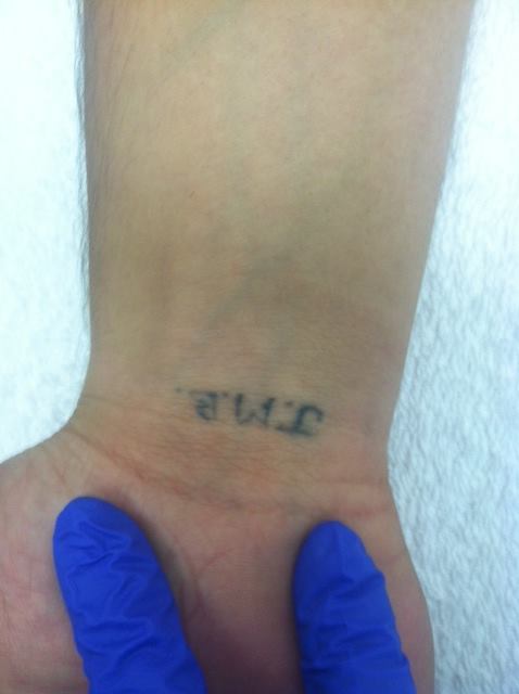 Tattoed wrist