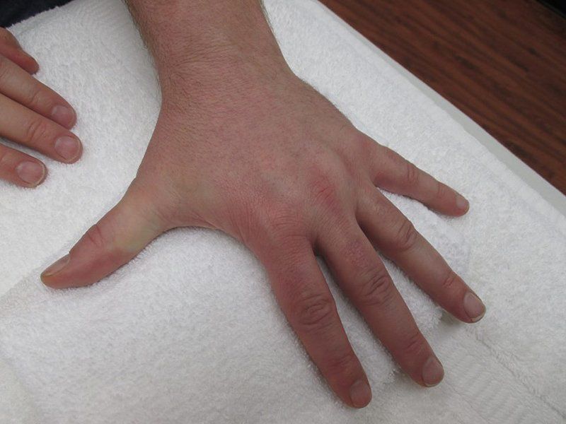 Hand