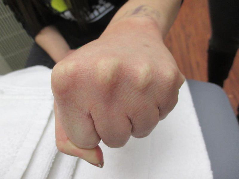 Fist
