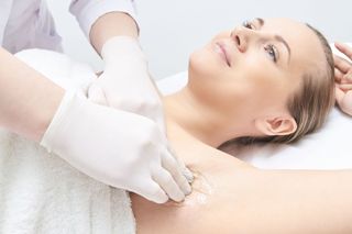 A woman is getting her underarm waxed by a doctor.