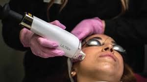 A woman is getting a laser treatment on her face.