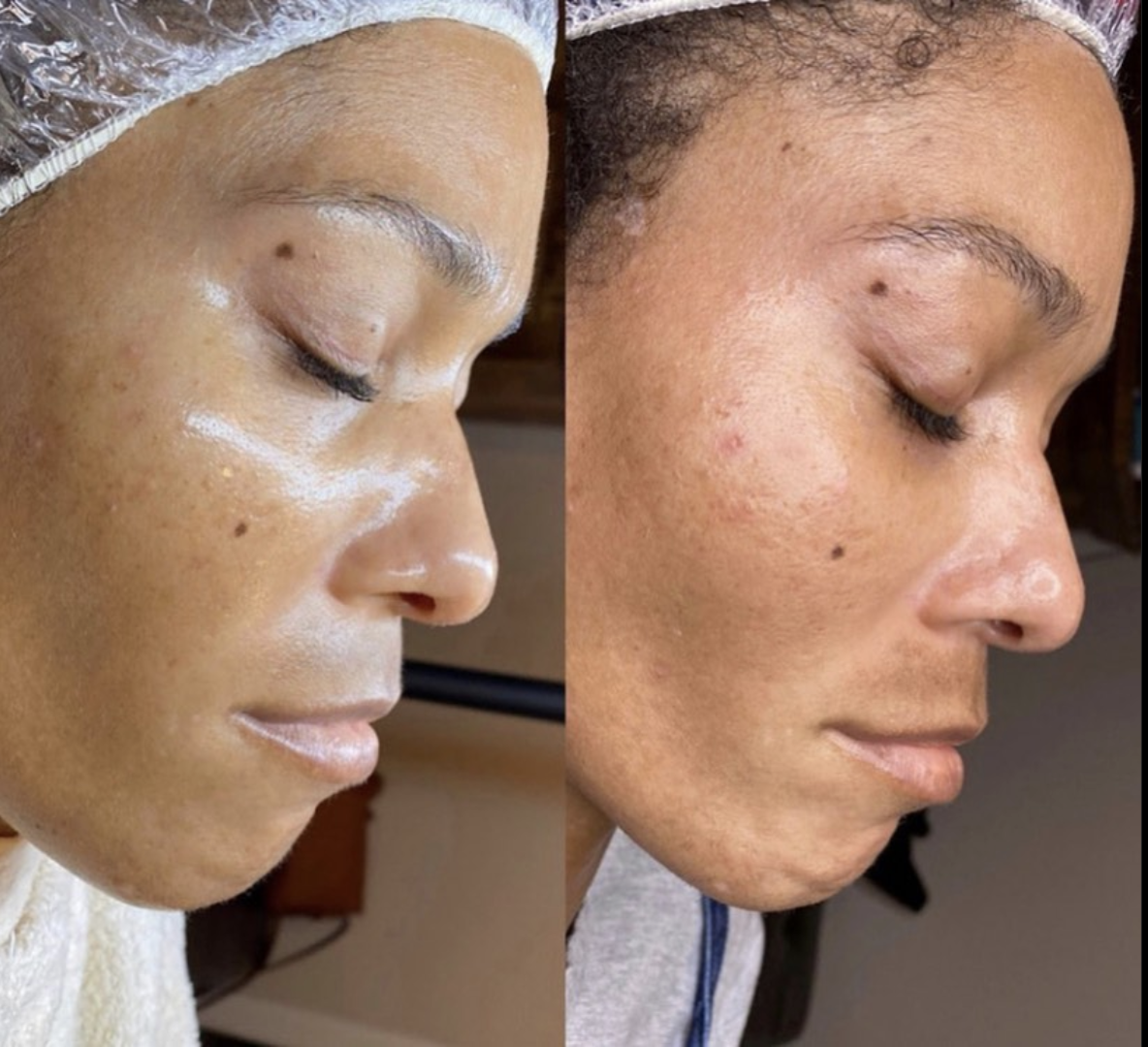 A before and after picture of a woman's face