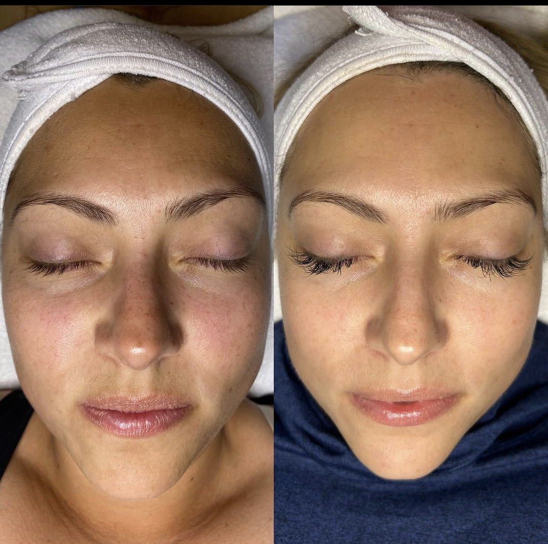 A woman with a towel on her head has her eyes closed