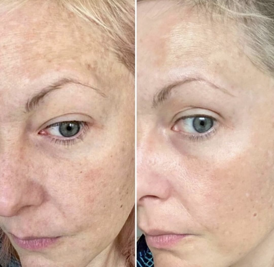 A before and after photo of a woman's face with and without makeup.