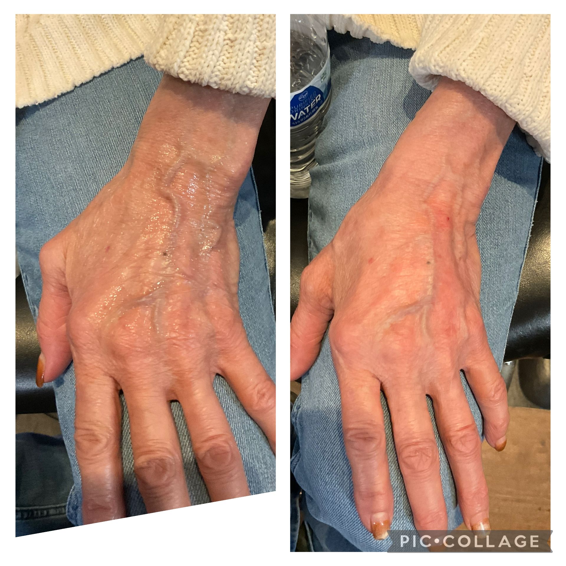 Two side-by-side photos of a hand on denim, comparing skin texture and veins under a cream sweater cuff