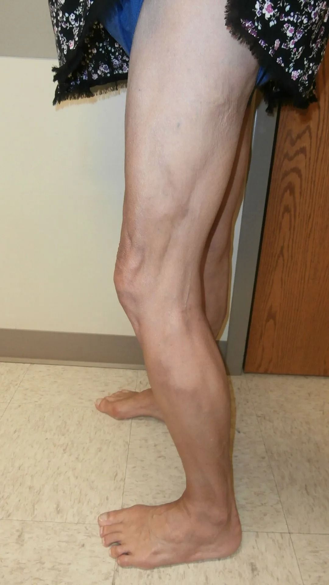 Person's lower body standing, visible legs and feet. Bent knees, bare feet on floor. Light skin, indoors near a wall and door.