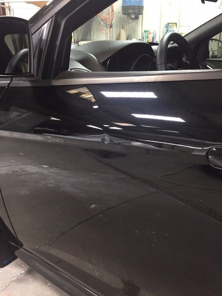 Dent removal