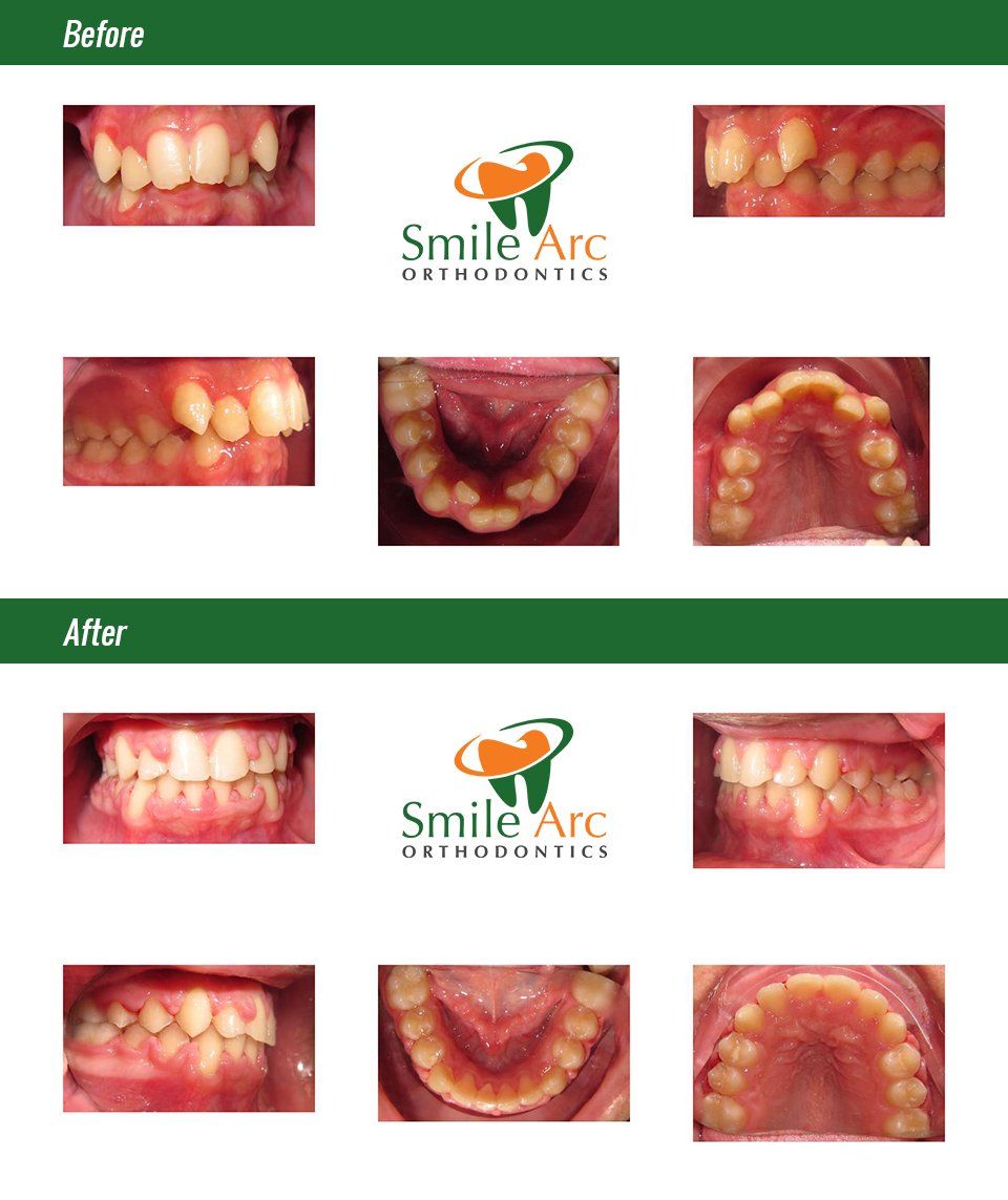 Before and After Dental service