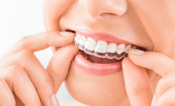 Hands adjusting clear braces on a smiling mouth