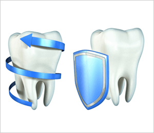 tooth shield