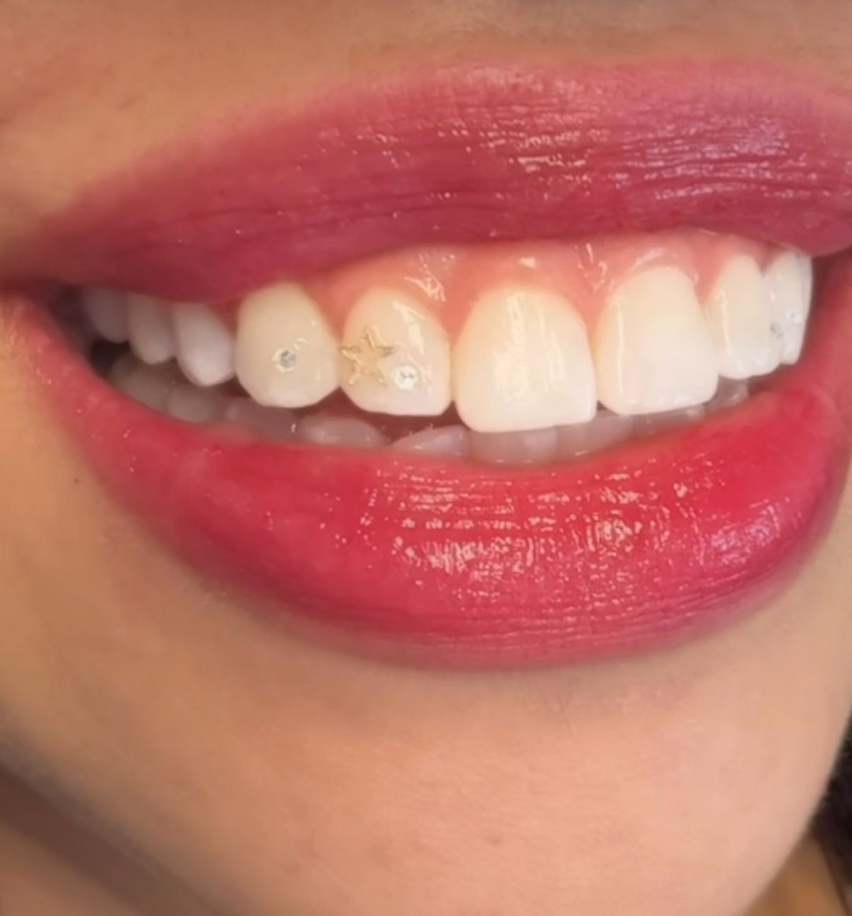 Close-up of a person smiling, showing white teeth with star and dot tooth gems, red lipstick.