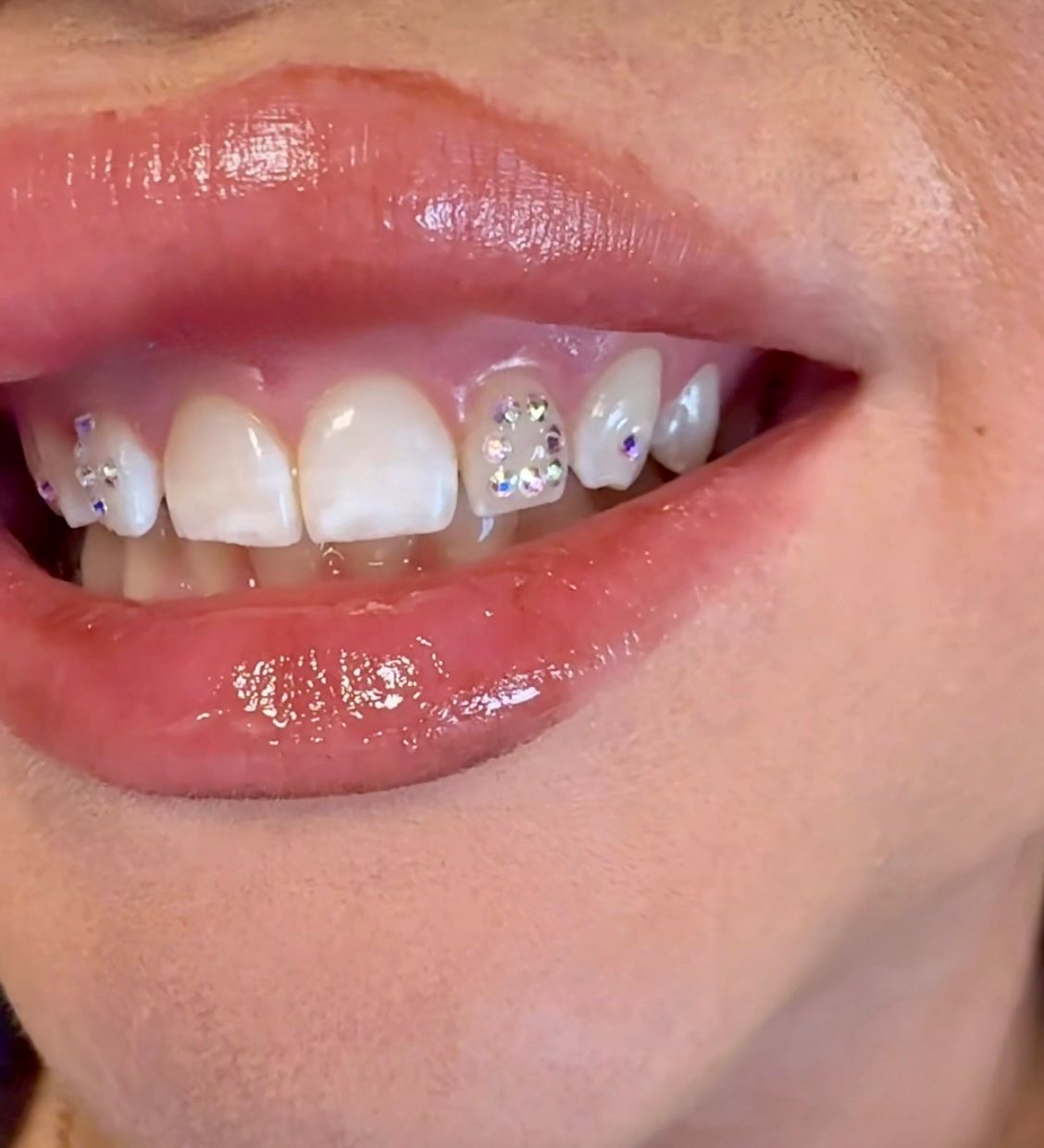 Close-up of a smiling mouth with bedazzled teeth and glossy, pink lips.