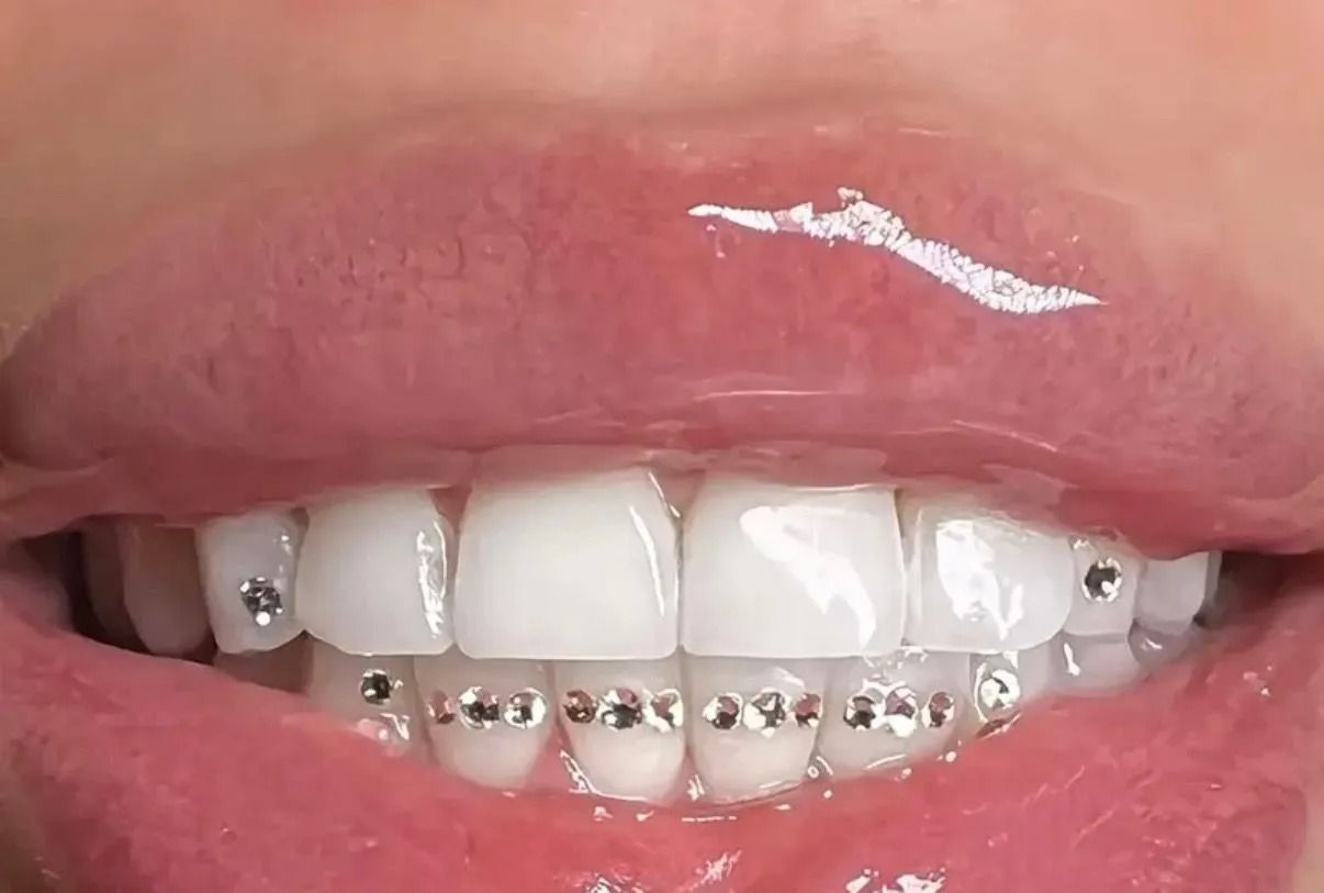 Close-up of a person's smiling mouth. The teeth are white with decorative crystals and glossy pink lips.