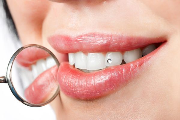 Close-up of a person's mouth with a tooth gem, reflected in a small dental mirror.