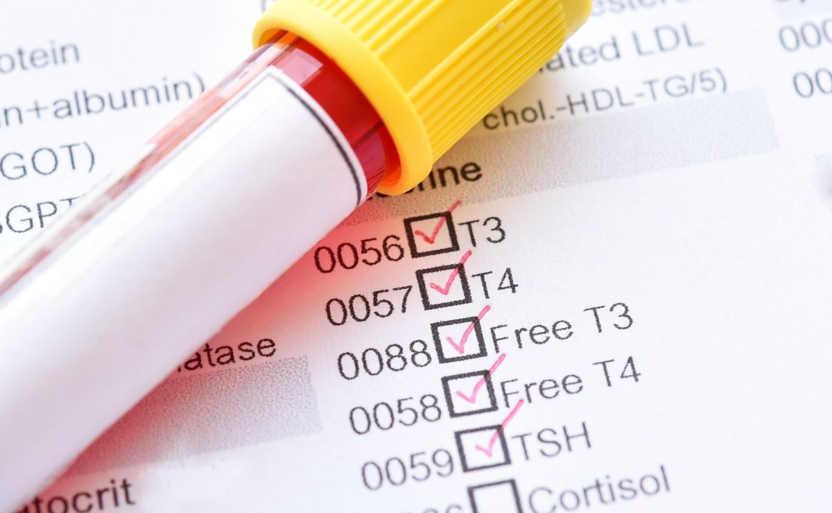 Thyroid blood test tube and requisition