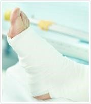 foot fracture