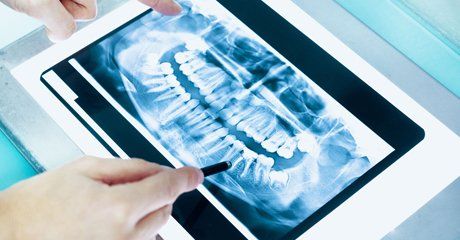 Dental radiography