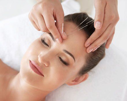 Learn More About Acupuncture Acupuncture treatment