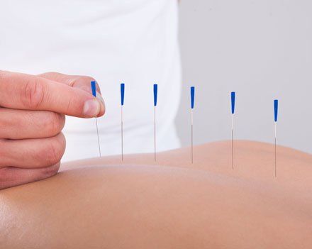 Learn More About Diagnosis and Steps of Care Acupuncture therapy