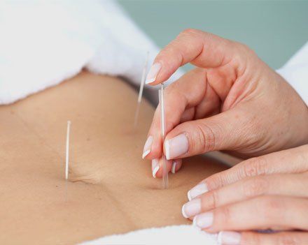 Learn More About Wellness Care Acupuncture therapy