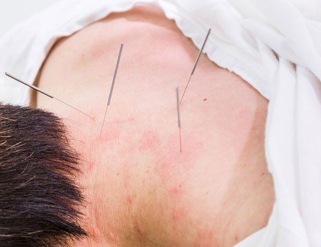 Acupuncture for skin disease