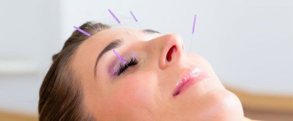 Acupuncture for health