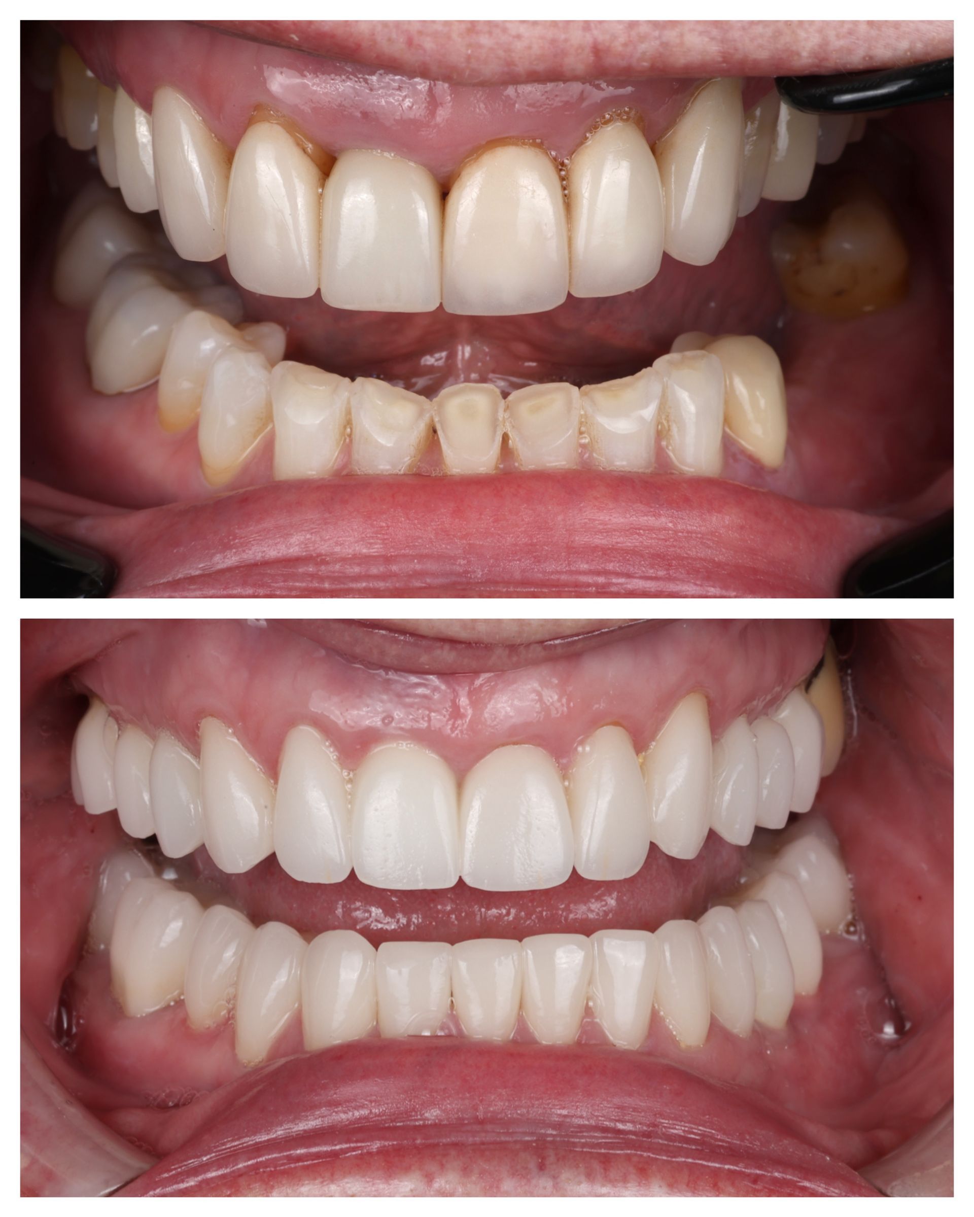Before and after dental work of Linda R.