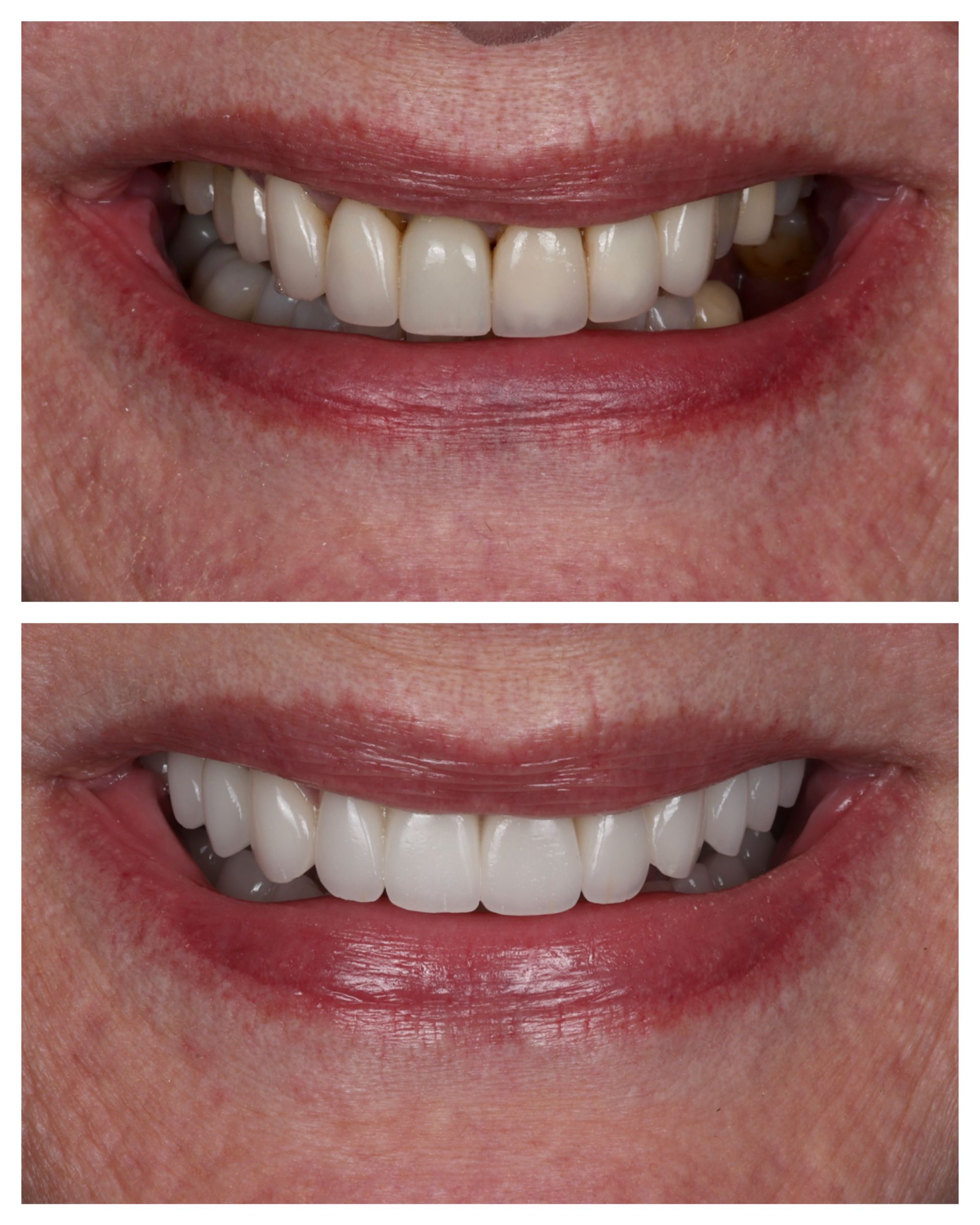 Before and after dental work of Linda R.
