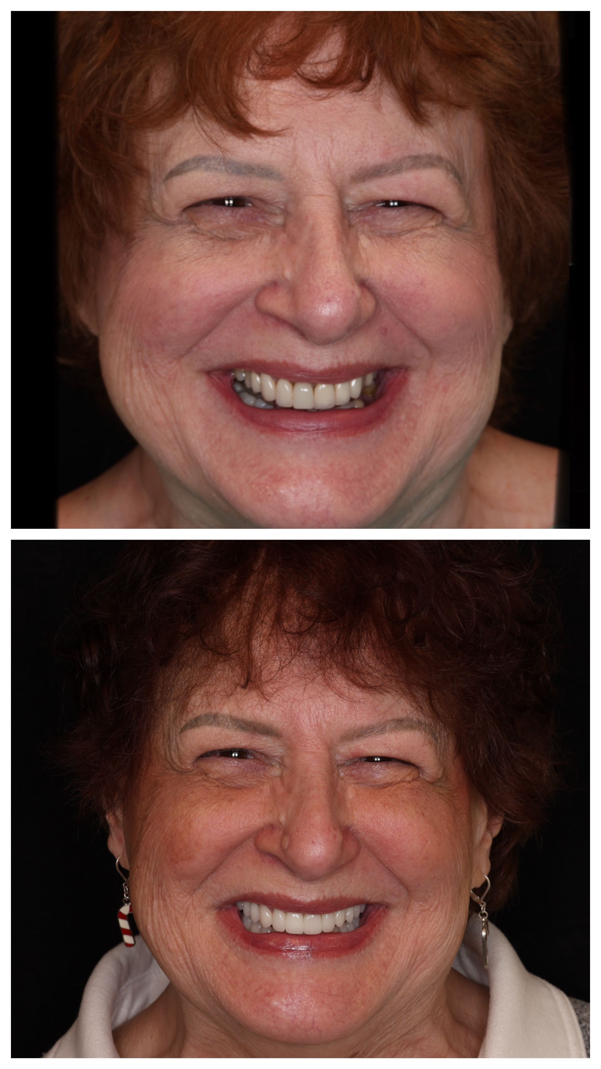 Before and after dental work of Linda R.