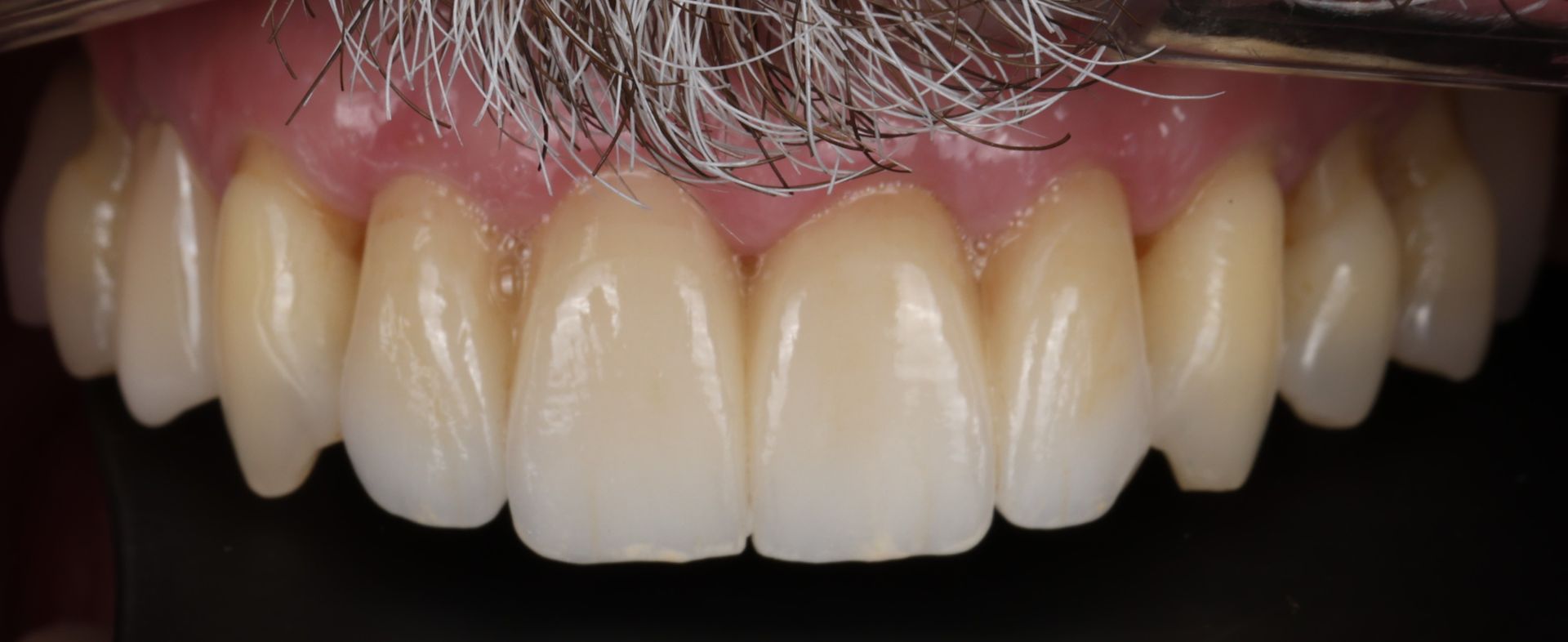 A close up of a man 's teeth with a beard.