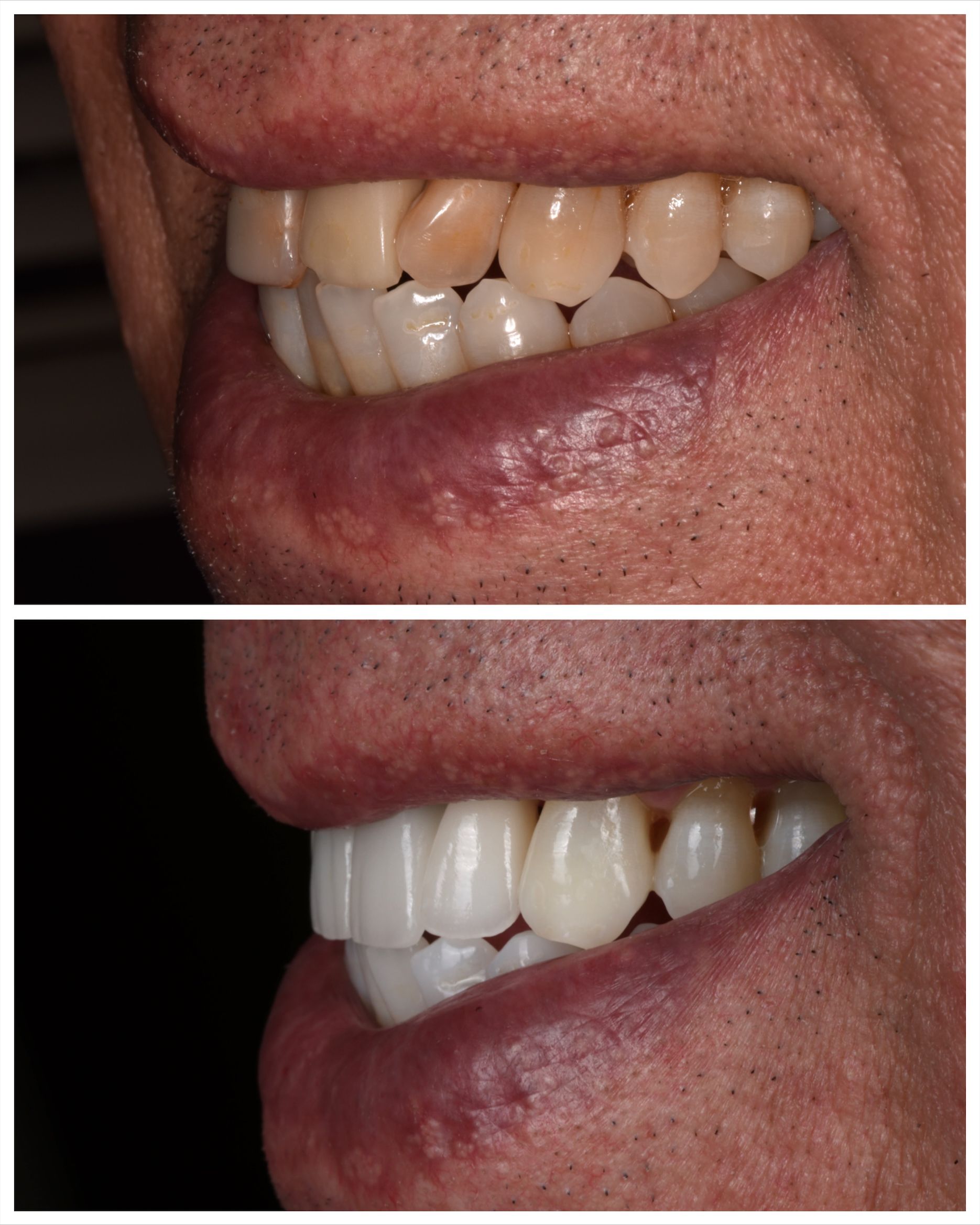 before and after dental work for Azzam