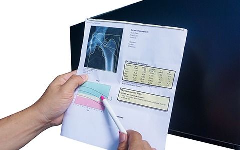 Person pointing at bone density scan report with an x-ray of a hip, near a dark screen.