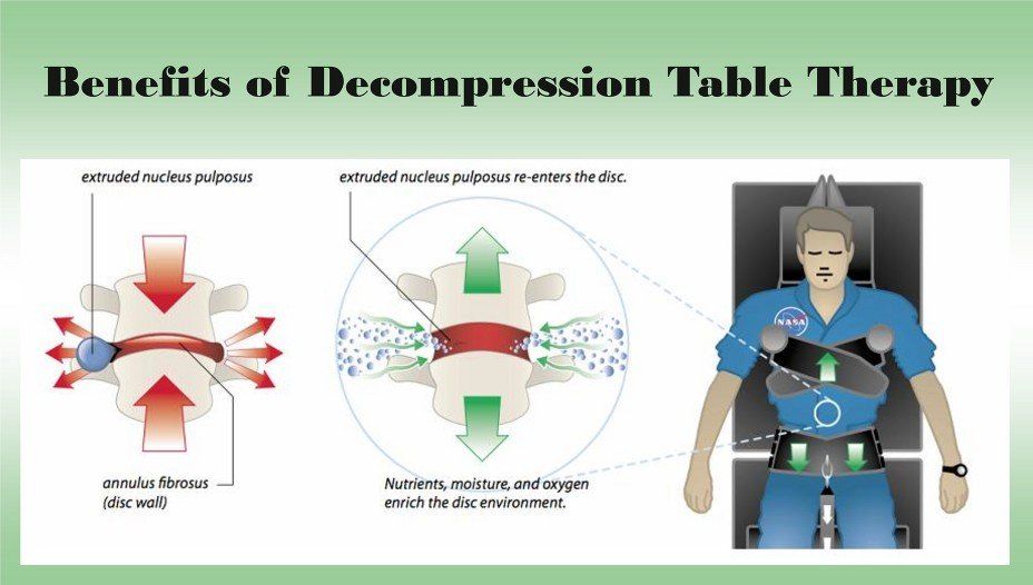 Benefits of Decompression Table Therapy