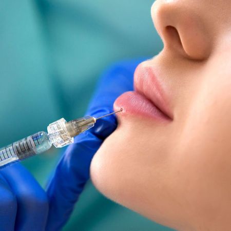 A woman is getting a botox injection in her lips.