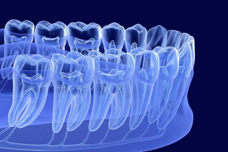 An x-ray of a row of teeth on a blue background.