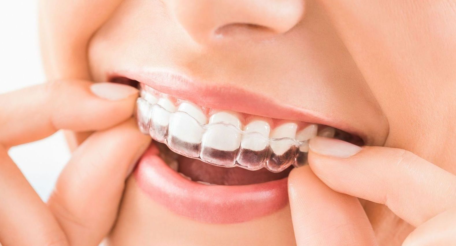 Orthodontic Services