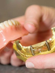 A person is holding a model of a denture with screws in it.