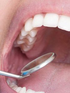 A close up of a person 's mouth with a dental mirror in it.