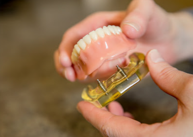 A person is holding a model of a denture in their hands.