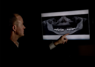 A man is pointing at an x-ray of a skull on a computer screen.