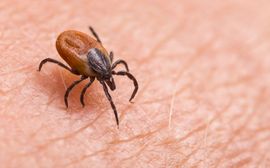 A tick is crawling on a person 's skin.